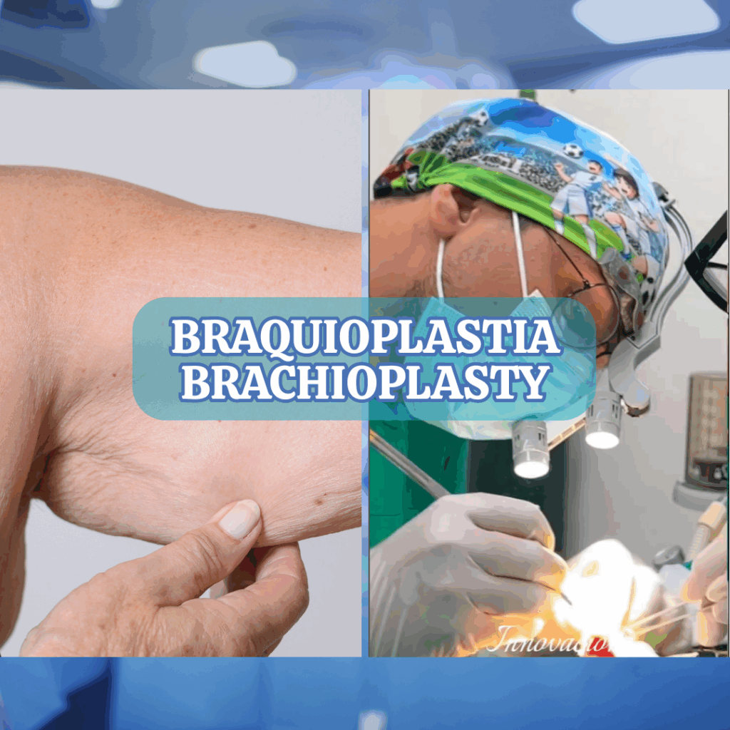 BRAQUIPLASTIA