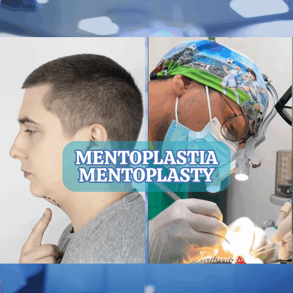 MENTOPLASTIA