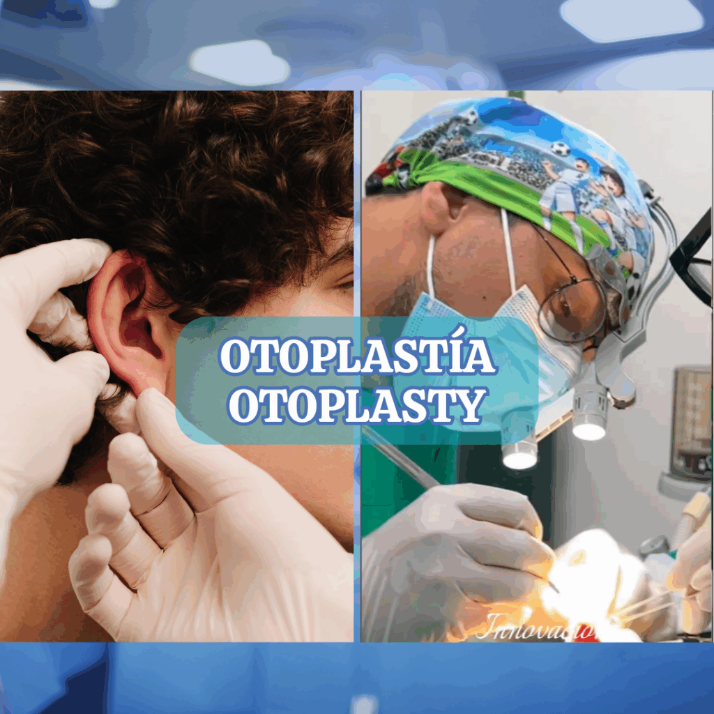 OTOPLASTIA