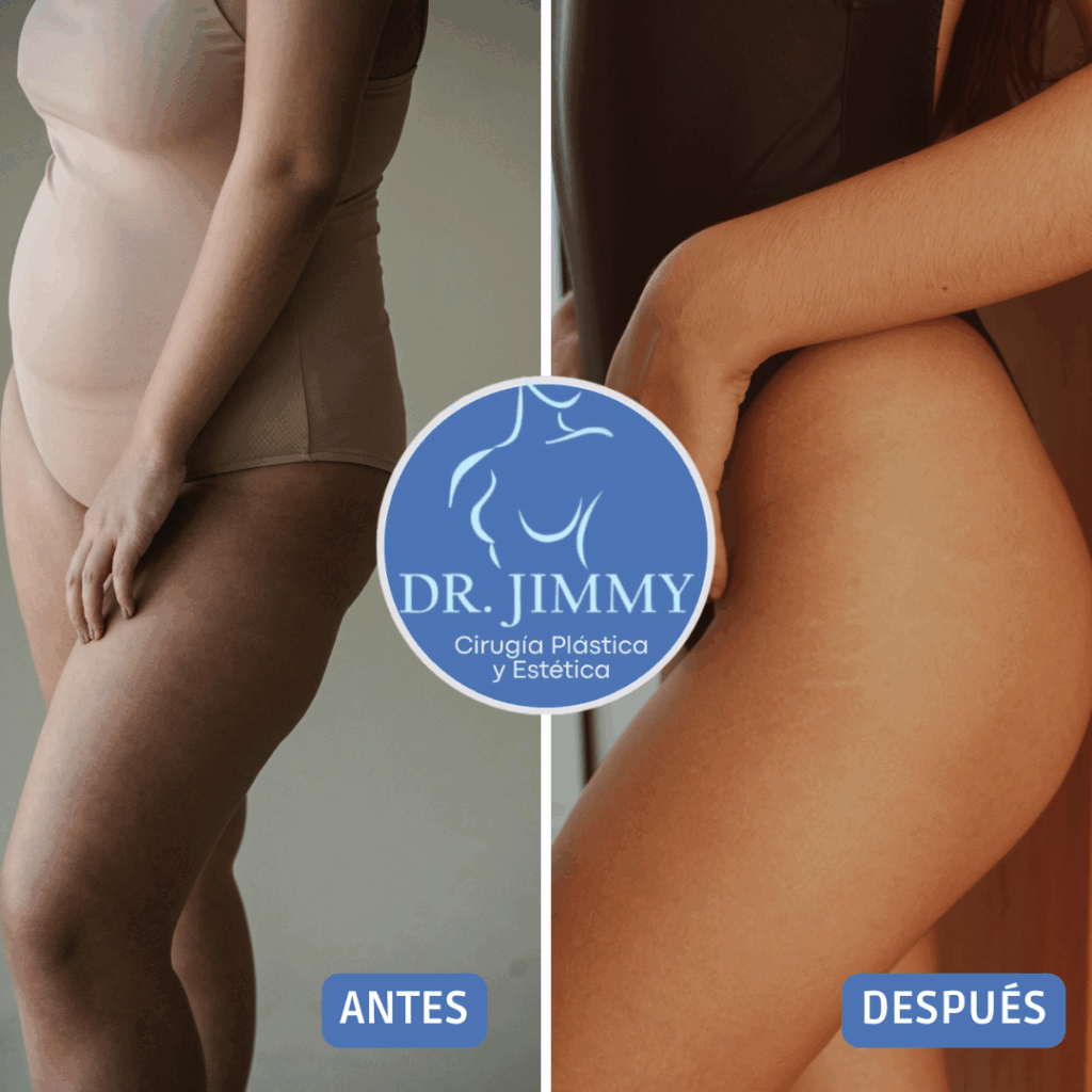 RECUR_INST_MOMMY MAKEOVER (1)